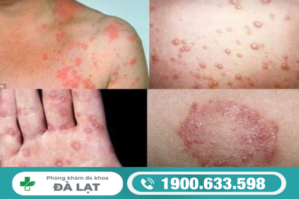 Hình ảnh minh họa